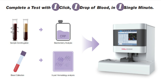 Machine d'essai clinique de CBC