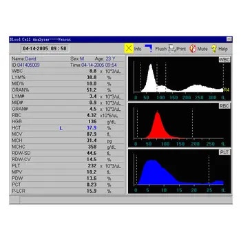 Analyseur automatique de hématologie de système ouvert analyseur vétérinaire de sang de 3 parts